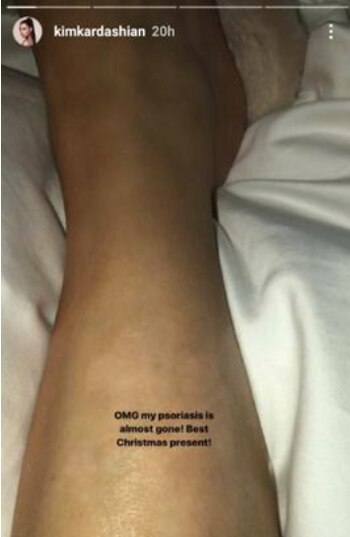 En sus redes sociales en