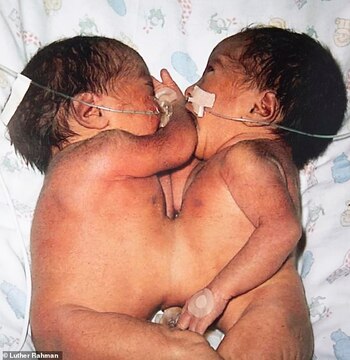 Jannat (izquierda) y Zainab antes