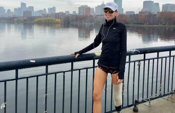 Adrianne perdió la pierna en