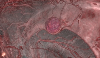 También los pacientes que esperan