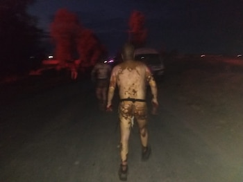 Las personas resultaron con quemaduras