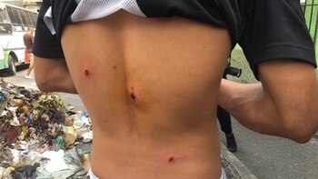 Un joven sufrió el impacto