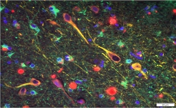 En color rojo, las bacterias