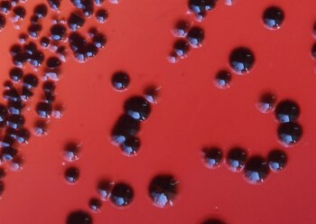 La bacteria P. gingivalis, responsable