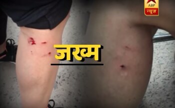 Imagen 2ZH4MKOOLRDTVCHVVWGRBIFNB4