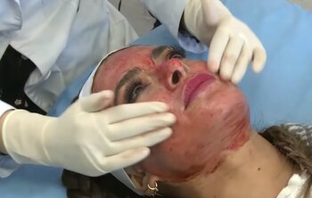 La sangre debe permanecer varias