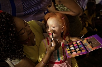 Elsie Lynn, de 6 años, se maquilla mientras espera el inicio del concurso Mr. & Miss Albinismo África del Este (Foto: Ben Curtis/AP)