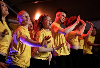 Los concursantes actúan al comienzo del concurso Mr. y Miss Albinismo África del Este (Foto: Ben Curtis/AP).
