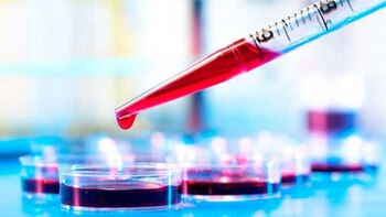 La biopsia líquida está en