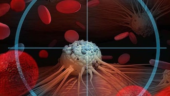 El tumor del paciente debe