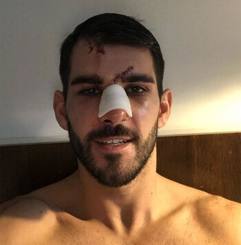 Así quedó Oliveira tras la