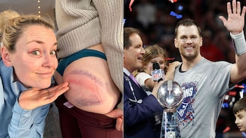 Lindsay Vonn mostró sus heridas