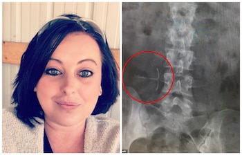 Melinda no tenía idea que