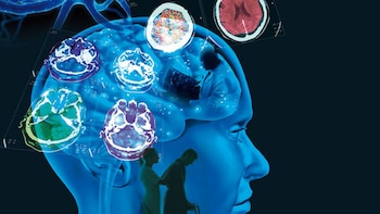 El método se dirige a