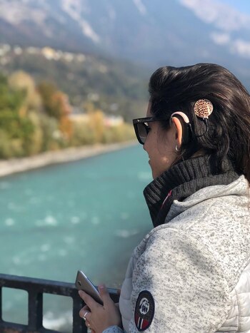 Bárbara tiene un implante coclear