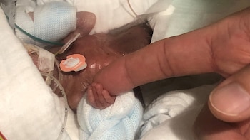 Así estaba el bebé cinco