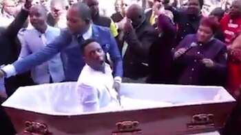 El pastor pone sus brazos