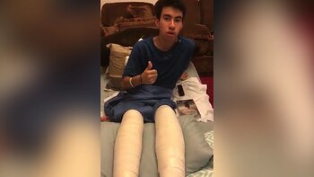 Un menor cayó de un