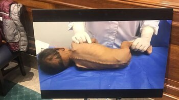 La imagen más impactante: la