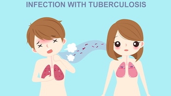 El contagio de esta enfermedad