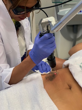 El láser picosegundos penetra en