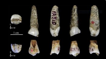 Las cuatro piezas dentales que