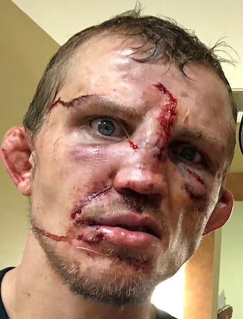 Jason Knight se comparó con ‘Chucky’, el muñeco maldito (@MMA_Fusion)