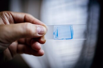 Shawn Lockhart, experto en infecciones