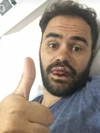 Así quedó “Pepe” después del