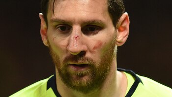 El argentino fue sometido a