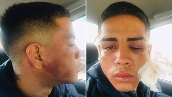 Facundo Maya quedó inconsciente tras