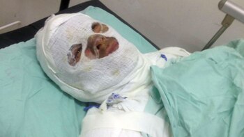 La víctima permanece en el