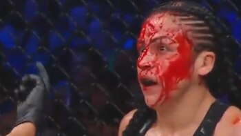 Así quedó el rostro de