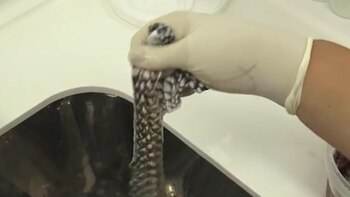 Antes de que los médicos