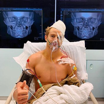 Así quedó Sage Northcutt tras