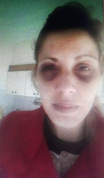 Cintia tras sufrir una agresión,