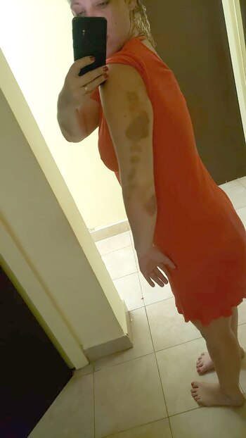 Así quedó el brazo de