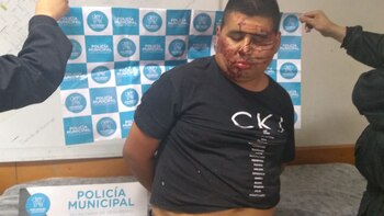 El policía bonaerense fue denunciado