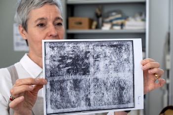 Hoppe con una radiografía que muestra a los nenúfares debajo de las glicinias. (Herman Wouters/The New York Times)