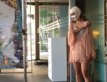 El rostro vendado de Yanet