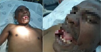 El acusado de 32 años