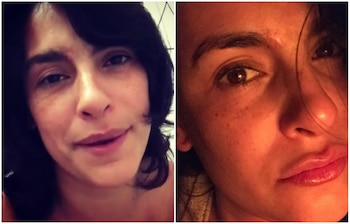 Liz Gallardo dice que las marcas en sus cejas aún son evidentes (Instagram)