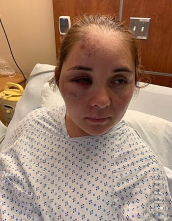 Tras el ataque, Ruiz sufrió