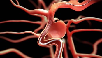 El dispositivo consiste en una