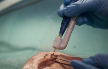 El aparato fue diseñado en