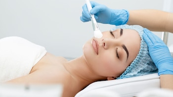 El peeling es uno de