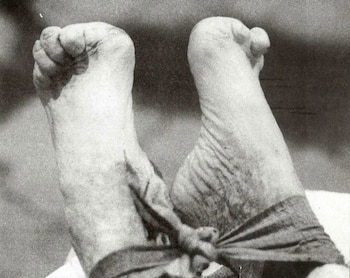 Los dedos mutilados de Roschmann que permitieron confirmar que el hombre que había muerto haciéndose llamar Federico Wegener era en realidad el criminal nazi (Nazis en las sombras /Editorial Atlántida)