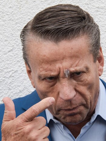 Adame muestra la herida que