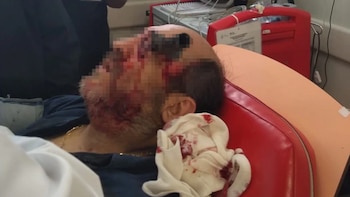 El agresor de la víctima fue vincualdo a proceso por el delito de homicidio doloso en grado de tentativa (Foto: Especial)