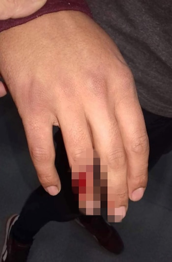 El chofer también sufrió una